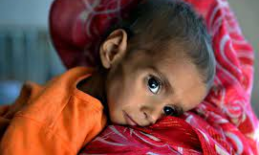 Three million children suffer from malnutrition in Afghanistan - WFP